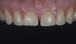 ceramica diastema walter devoto