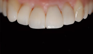 denti bianchi genova liguria