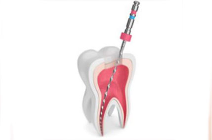 Endodontica
