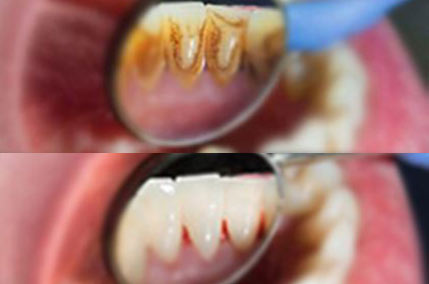 igiene dentale valter devoto sofia genova santa margherita